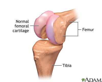 Partial knee replacement - series