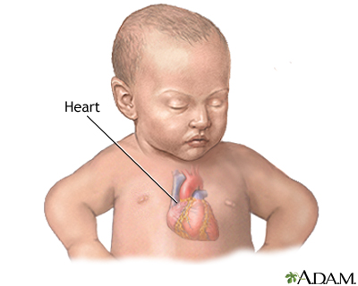 Patent ductus arteriosis (PDA) - series - Infant heart anatomy