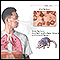Hantavirus Hantavirus