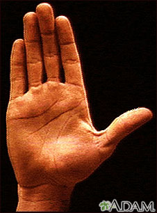 Anatomía de la superficie de la palma de la mano normal