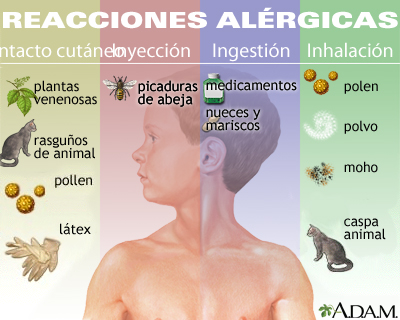 Reacciones alérgicas