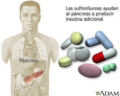 Drogas sulfonilureas