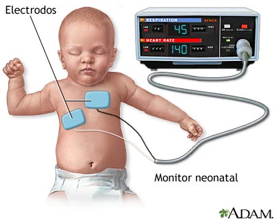 Monitor cardíaco-respiratorio