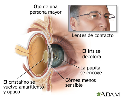 Anatomía de un ojo envejecido