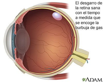 Procedimiento, parte 5 Procedimiento, parte 5