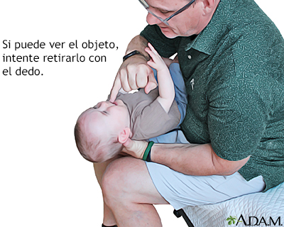 Retire el objeto si puede verlo Retire el objeto si puede verlo