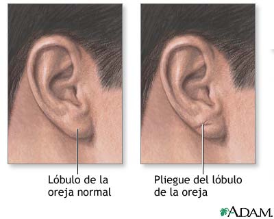 Pliegue del lóbulo de la oreja