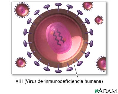 Infección VIH asintomática