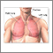 Lobectomía pulmonar - serie - Anatomía normal