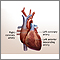 Cirugía de derivación cardíaca - serie - Anatomía normal