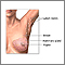 Mastectomía - serie - Anatomía normal