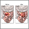 Antes y después de anastomosis del intestino delgado