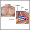 Anatomía de la salida del tórax