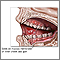 Úlceras de la boca