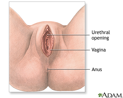 Anterior vaginal wall repair (surgical treatment of urinary incontinence) - series
