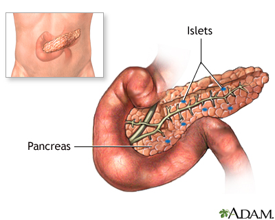 Pancreas transplant - series