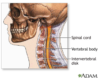 Spinal surgery - cervical - series