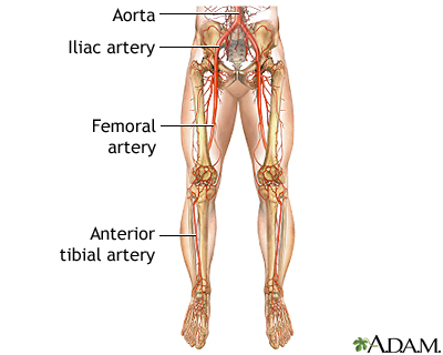 Arterial Bypass Leg Series Normal Anatomy Medlineplus Medical