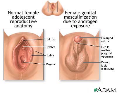 Developmental disorders of the vagina and vulva