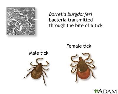 Tertiary Lyme disease