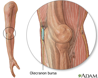 Bursa of the elbow