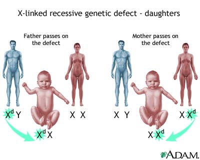 X-linked recessive genetic defects - how girls are affected