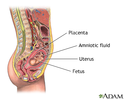 Amniocentesis - series - Indication