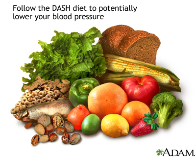 Understanding the DASH diet: MedlinePlus Medical Encyclopedia