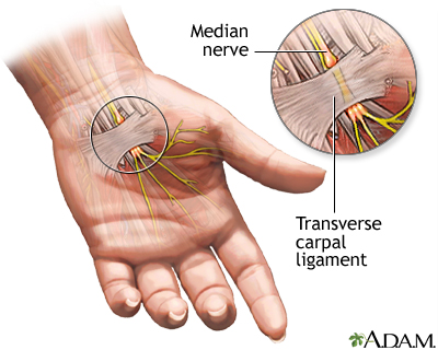 What Nerve Causes A Fist