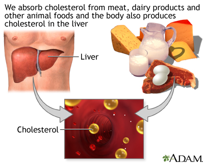High blood cholesterol levels: MedlinePlus Medical Encyclopedia