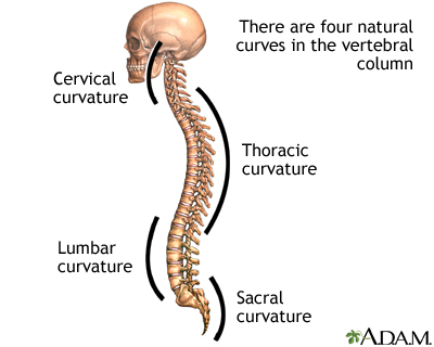 Spinal curves: MedlinePlus Medical Encyclopedia Image