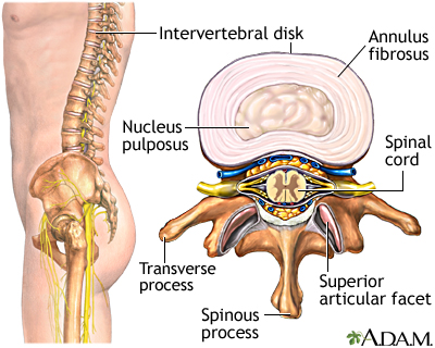 Intervertebral disk