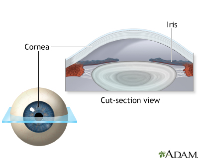 Lasik eye surgery - series - Normal anatomy