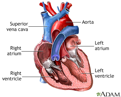 Single chamber heart