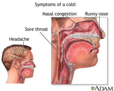 How Long Does Strep Throat Last? - lethow.com