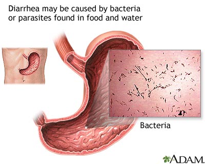 Diarrhea Medlineplus Medical Encyclopedia, How To Keep Stools Loose