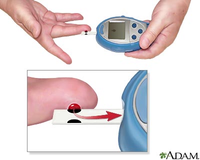 Blood Glucose Monitoring - an overview