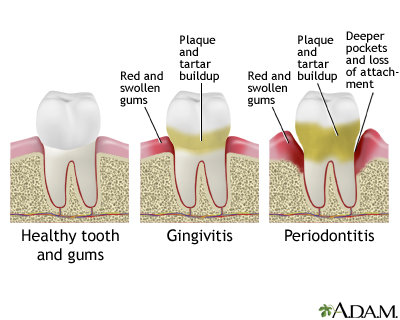 Dental Harmony: Nurturing Your Tooth Health