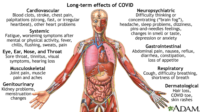 Long-term effects of COVID
