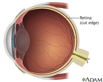 Retinal detachment repair - normal anatomy