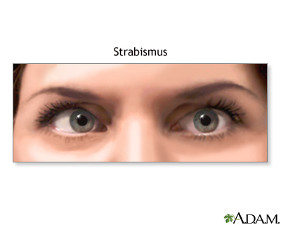 Indications - Presentation