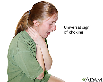 Signs of choking