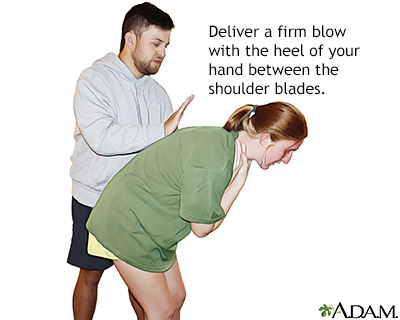 Perform back blows
