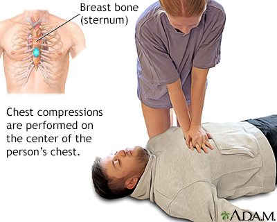 Continue chest compressions