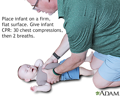 Infant loses alertness