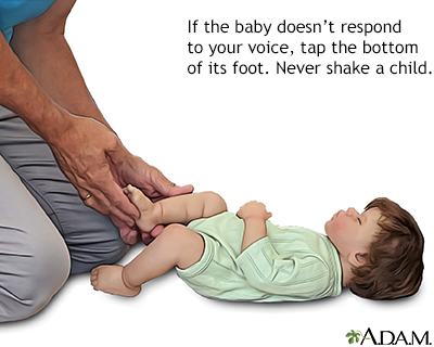 Check for alertness