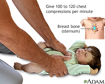 Continue chest compressions