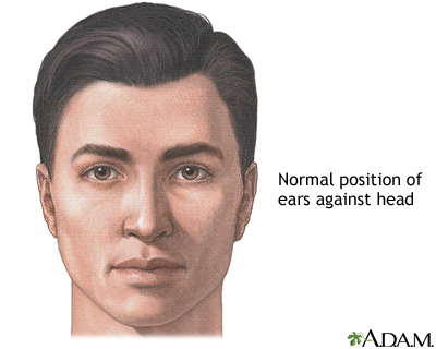 Ear surgery - series