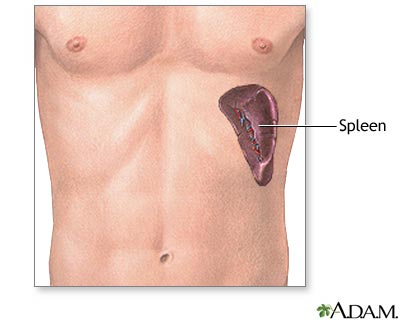 Spleen removal - series