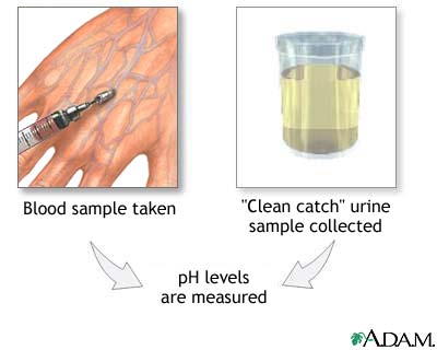 PH urine test